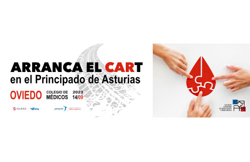 ARRANCA EL CART en el Principado de Asturias
